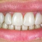 Orthodontist Or Dentist – Knowing The Difference